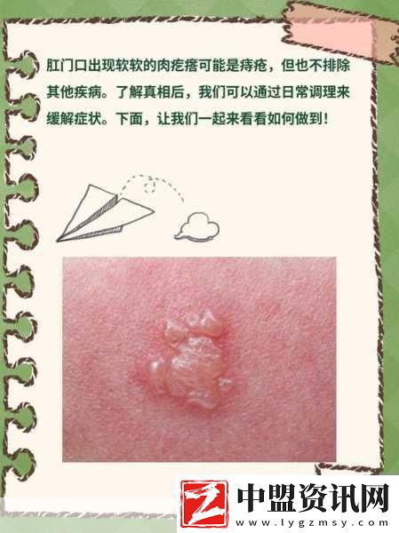 肛門口摸到個(gè)軟軟的肉要怎么消除